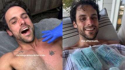 Jack Falahee gets his chest waxed