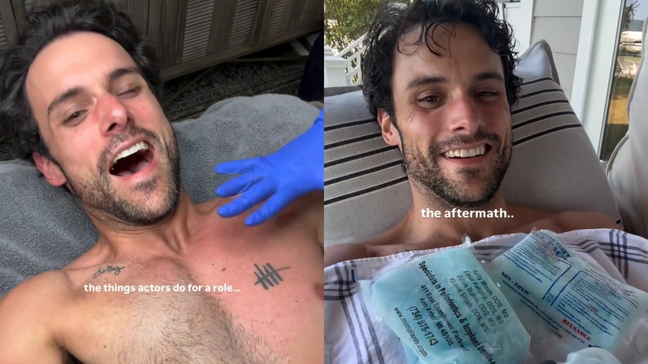 Jack Falahee Shares Hilarious ‘Aftermath’ After Getting His Chest Waxed! Jack Falahee Shares Hilarious 'Aftermath' After Getting His Chest Waxed!