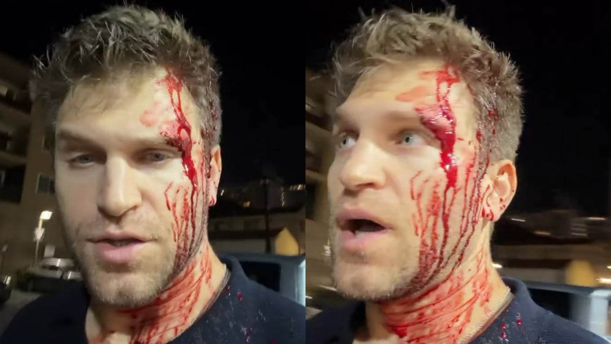 Pretty Little Liars’ Keegan Allen Attacked, Robbed at Gunpoint (Video)